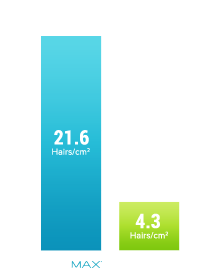 http://www.hairmax.com/wp-content/uploads/2015/06/graph1.png